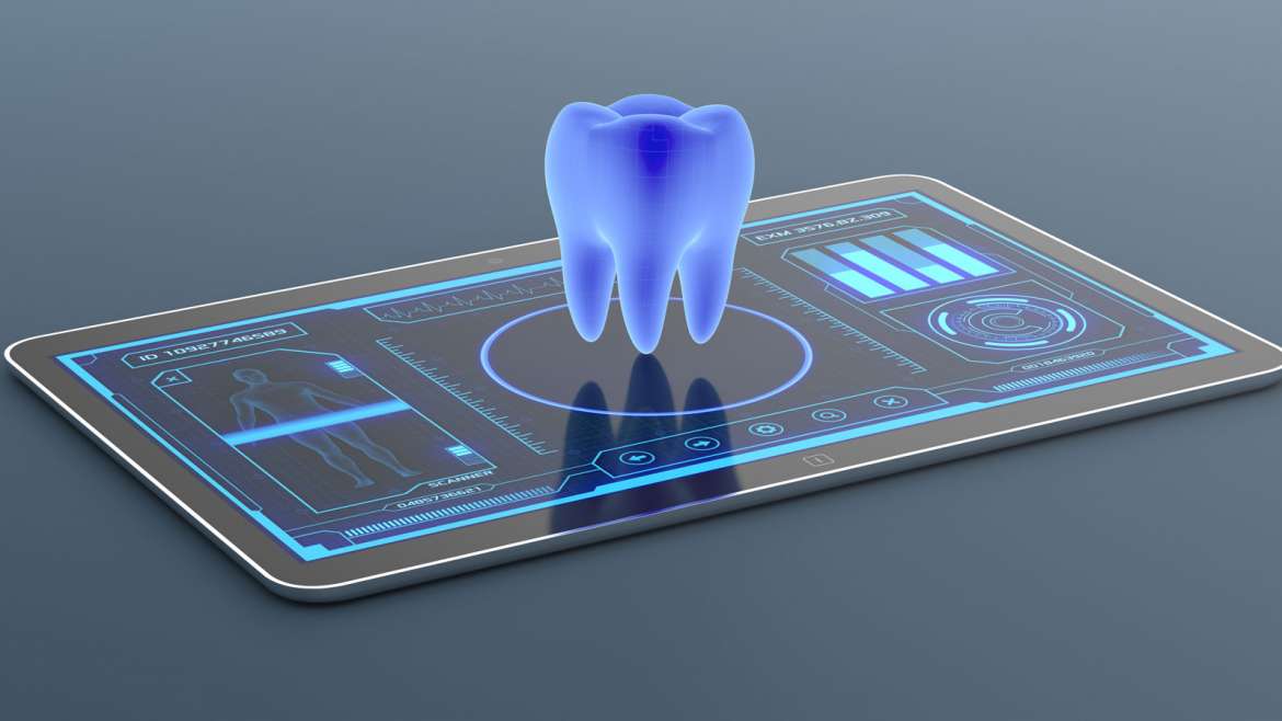 Scanner cad/cam